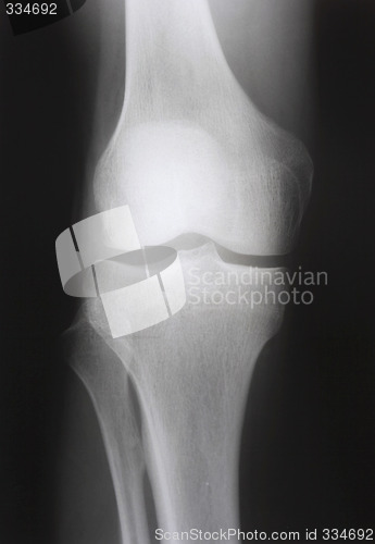 Image of X-ray photograph