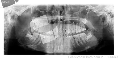 Image of Dental X-Ray