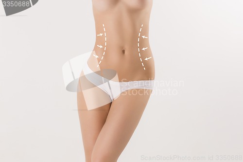 Image of Body correction with the help of plastic surgery on white background