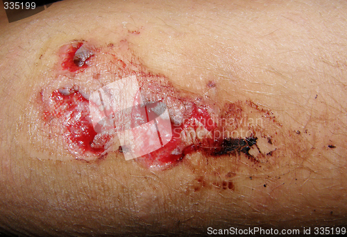 Image of wound,graze