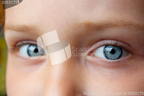 Image of teen's blue eyes staring up