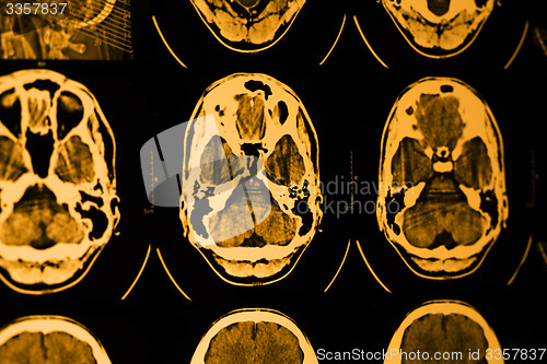 Image of CT and MRI of the skull