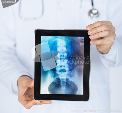 Image of male doctor holding tablet pc with x-ray