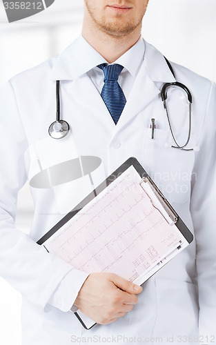 Image of nurse and male doctor holding cardiogram