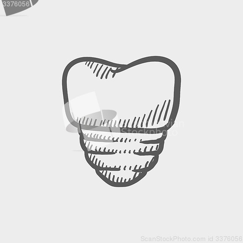 Image of Tooth implant sketch icon