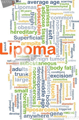 Image of Lipoma background concept