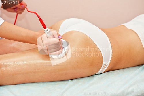 Image of procedure