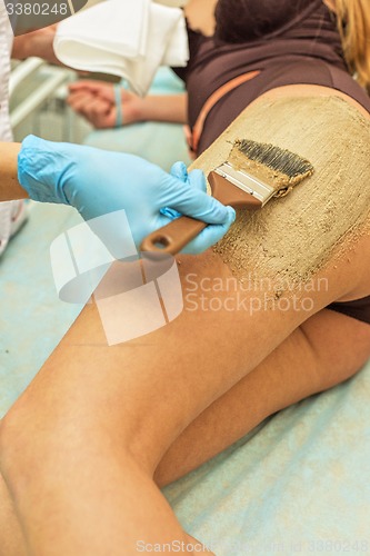 Image of procedure
