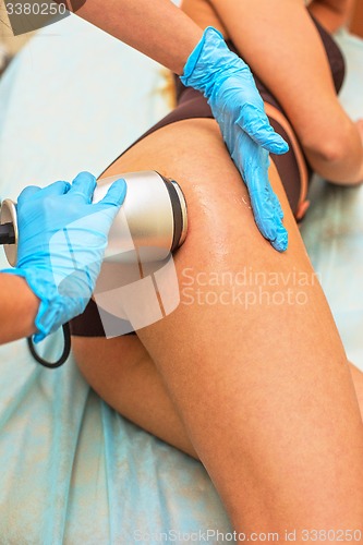 Image of procedure