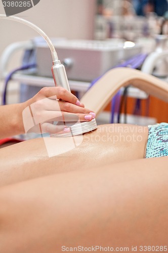 Image of procedure