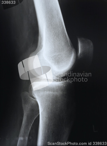 Image of X-ray