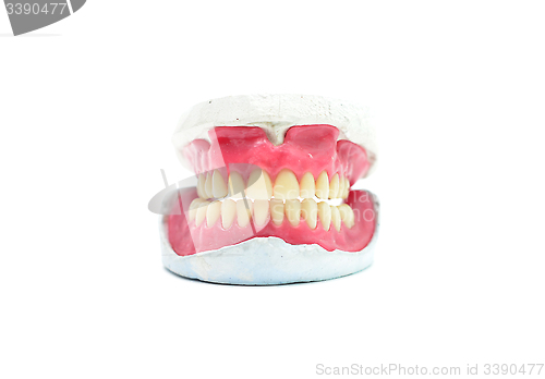 Image of teeth mold
