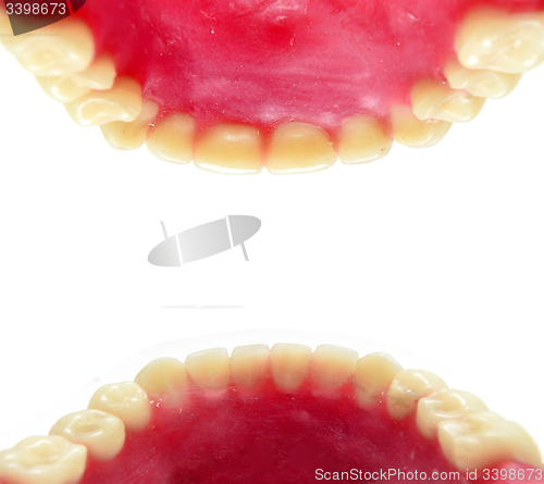 Image of teeth mold