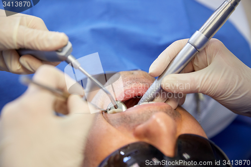 Image of dentist hands treating male patient teeth