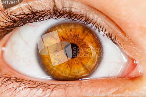 Image of Human eye.