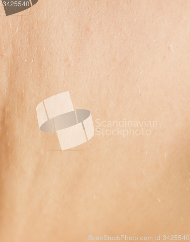 Image of wrinkled skin