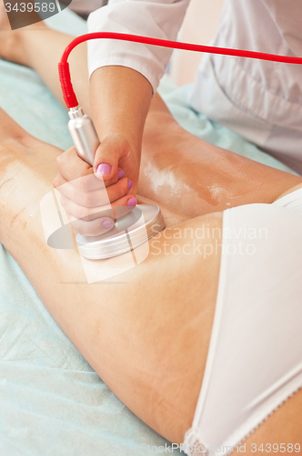 Image of procedure