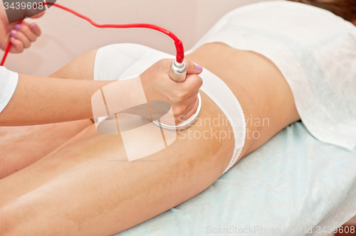 Image of procedure