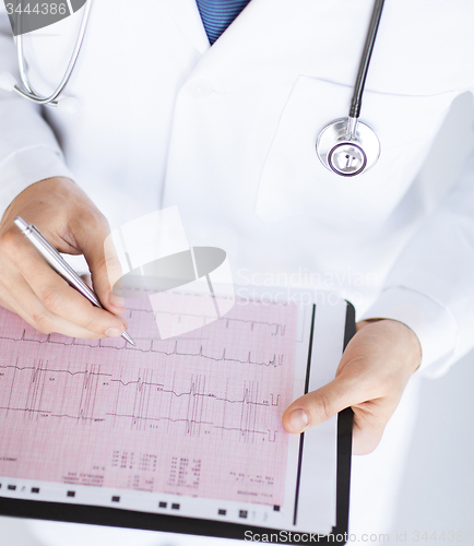 Image of male doctor hands with cardiogram