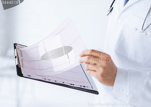 Image of male doctor hands holding cardiogram