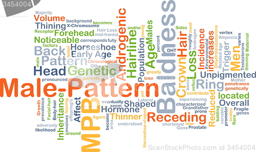 Image of Male-pattern baldness background concept