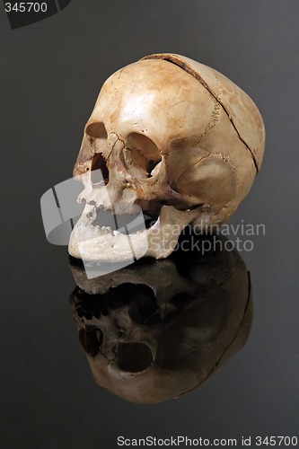 Image of real skull