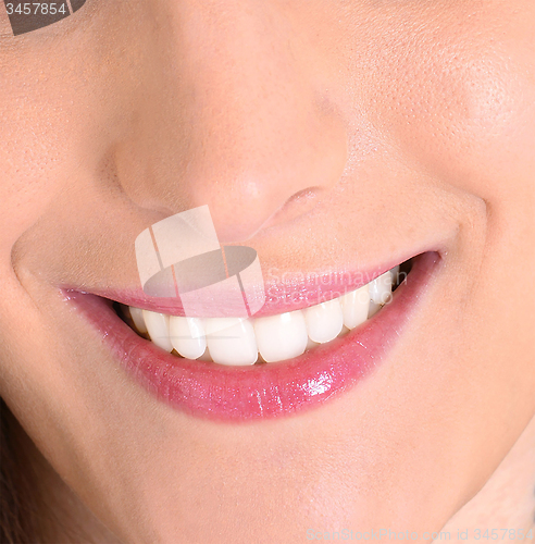 Image of closeup of smile with white healthy teeth