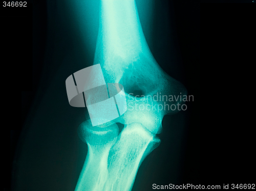 Image of x-ray of a male arm joint
