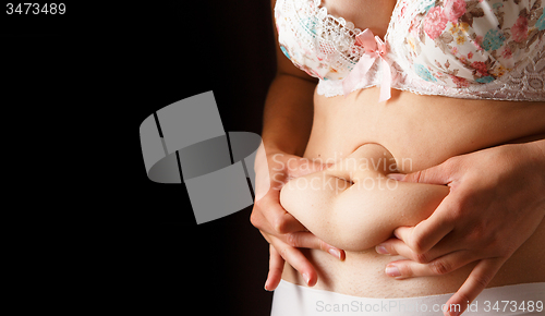 Image of Image of woman with excess weight