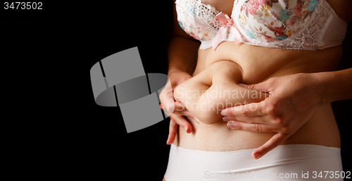 Image of Image of woman with excess weight