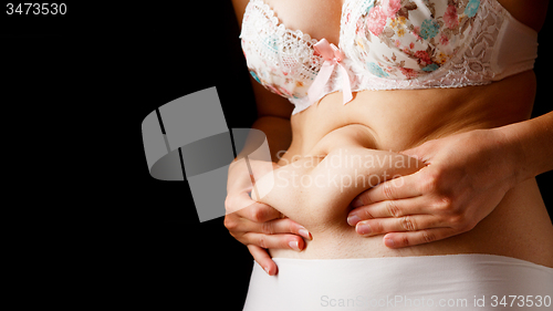 Image of Image of woman with excess weight