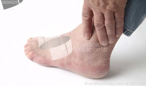 Image of painful ankle	