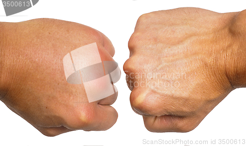Image of Comparing swollen male hands isolated towards white background