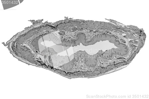 Image of Black and white Epithelium micrograph
