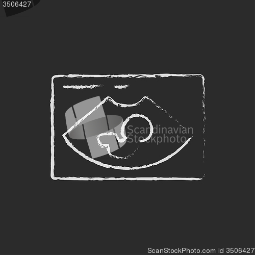 Image of Fetal ultrasound icon drawn in chalk.