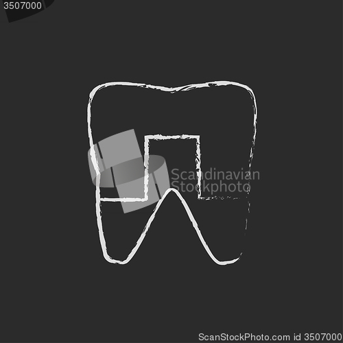 Image of Crowned tooth icon drawn in chalk.