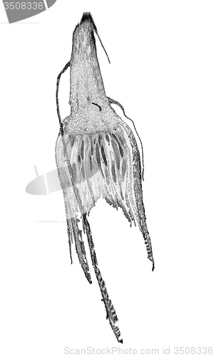 Image of Black and white Moss protonemata micrograph