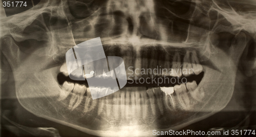 Image of Dental x-ray