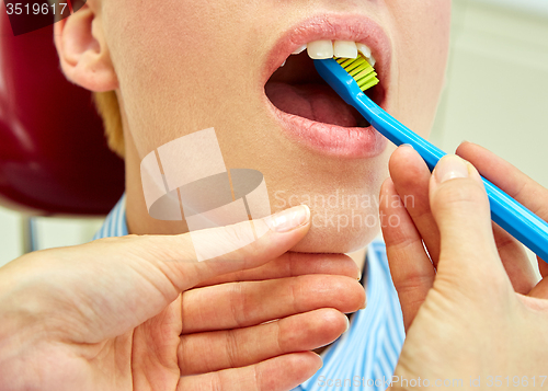 Image of the correct use of a tooth brush for perfect oral hygiene