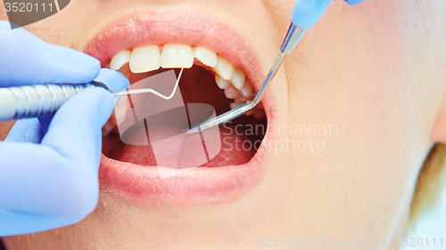 Image of Close-up of a pretty patient with her mouth open
