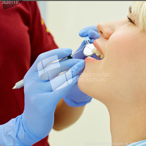 Image of Examining teeth