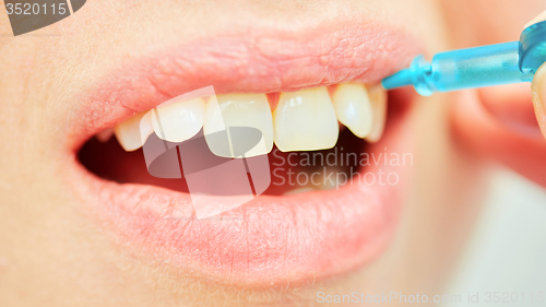 Image of the correct use of a tooth brush for perfect oral hygiene