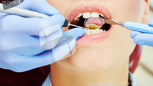 Image of Examining teeth