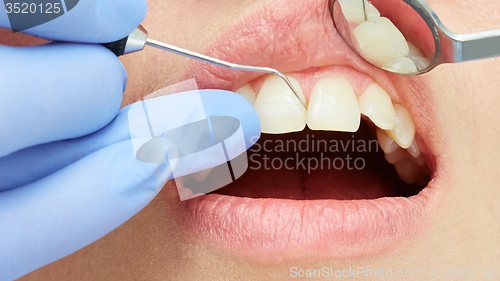 Image of Examining patient&amp;#39;s teeth