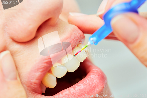 Image of the correct use of a tooth brush for perfect oral hygiene