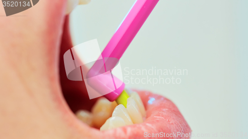 Image of Dentist showing a woman how to brush her teeth