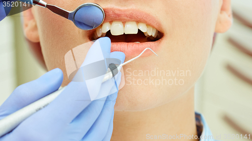 Image of Examining teeth