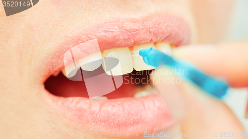 Image of the correct use of a tooth brush for perfect oral hygiene