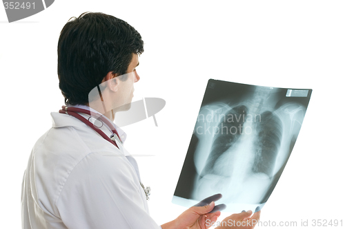 Image of Oncologist with chest  x-ray
