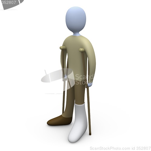 Image of Person With Broken Foot